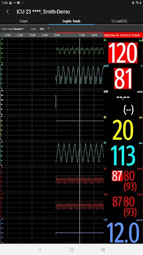 Descargar Mindray Mobile Viewer: Monitoreo Médico en Tiempo Real - Screenshot 15