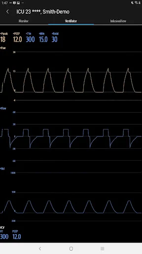 Descargar Mindray Mobile Viewer: Monitoreo Médico en Tiempo Real - Screenshot 20