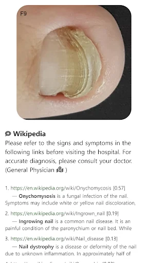 Model Dermatol: Atlas de Enfermedades de la Piel – Descarga Gratis - Screenshot 14