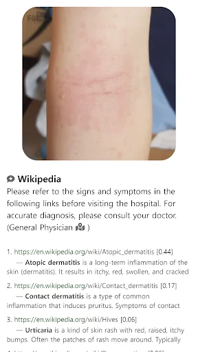 Model Dermatol: Atlas de Enfermedades de la Piel – Descarga Gratis - Screenshot 13