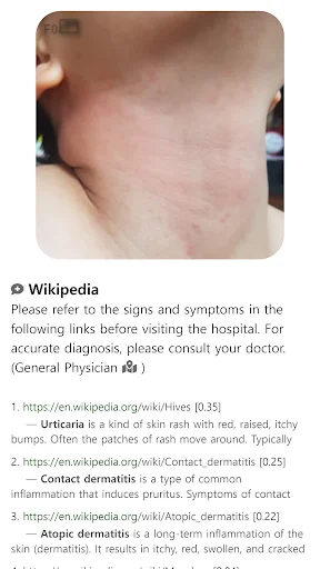 Model Dermatol: Atlas de Enfermedades de la Piel – Descarga Gratis - Screenshot 12