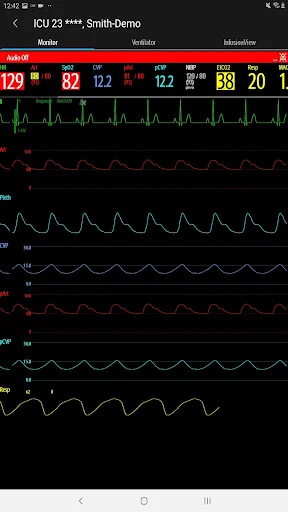 Descargar Mindray Mobile Viewer: Monitoreo Médico en Tiempo Real - Screenshot 19