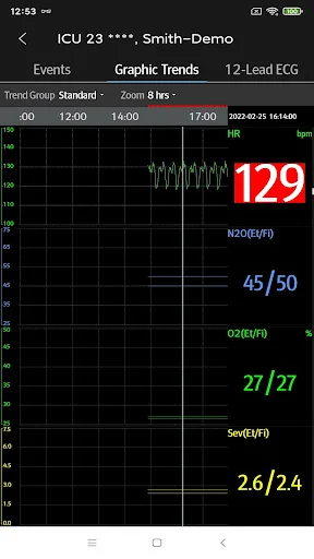 Descargar Mindray Mobile Viewer: Monitoreo Médico en Tiempo Real - Screenshot 7