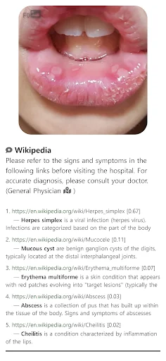 Model Dermatol: Atlas de Enfermedades de la Piel – Descarga Gratis - Screenshot 8