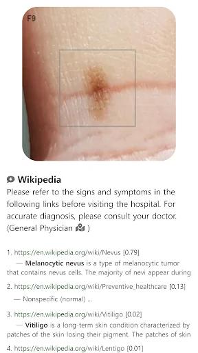 Model Dermatol: Atlas de Enfermedades de la Piel – Descarga Gratis - Screenshot 10