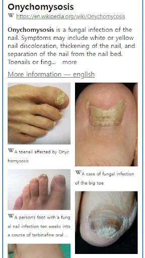 Model Dermatol: Atlas de Enfermedades de la Piel – Descarga Gratis - Screenshot 2