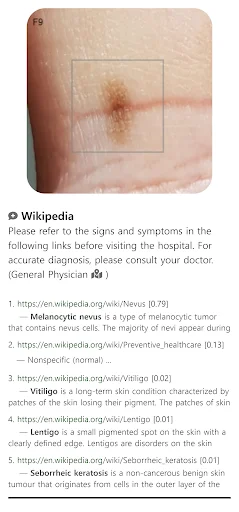 Model Dermatol: Atlas de Enfermedades de la Piel – Descarga Gratis - Screenshot 4